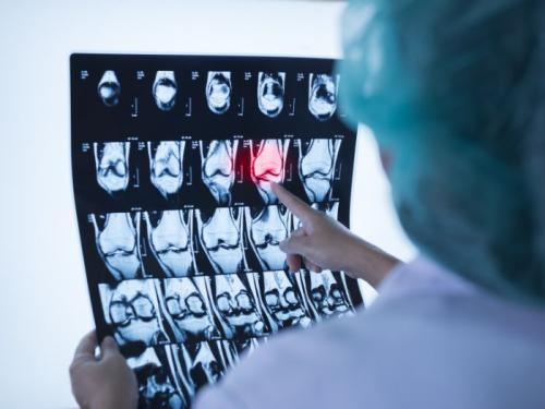 A doctor pointing at an xray