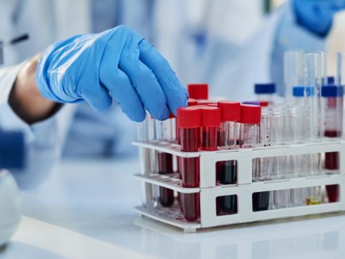 A hand in a blue latex glove reaching for a test tube of blood